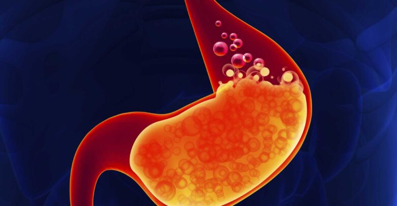 دراسة تكشف سبباً غريباً لحموضة المعدة