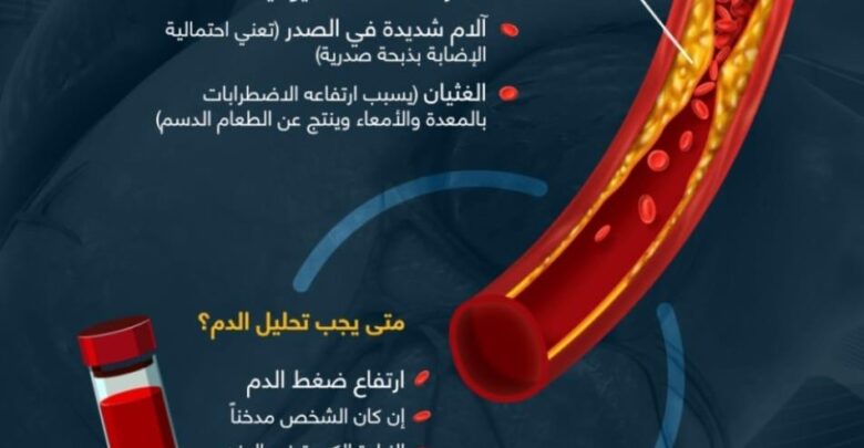 علامات ارتفاع الكوليسترول في الدم وطرق الوقاية منه