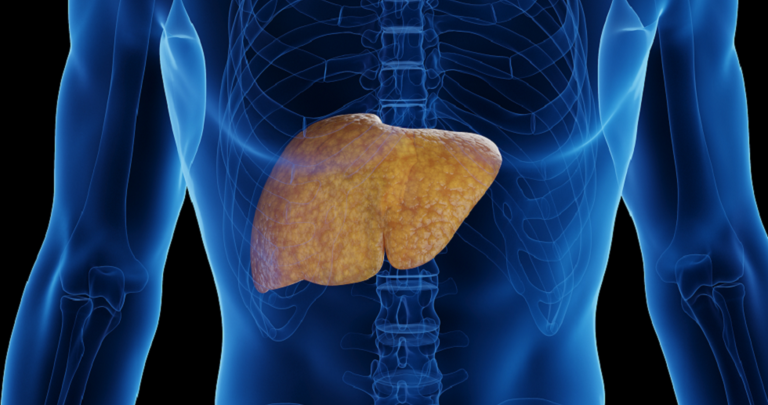 تحذير هام لمرضى الكبد من غذاء شائع